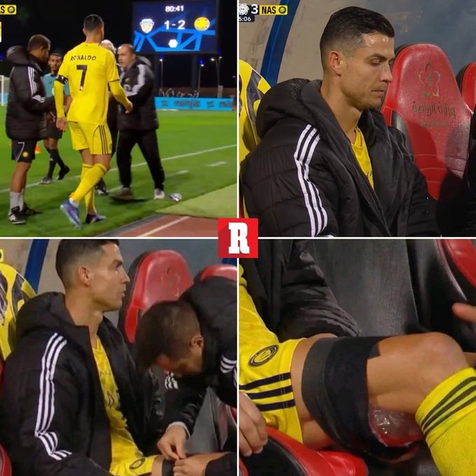 美媒：C罗可能是腿筋受伤，若情况属实或影响他参加3月国家队比赛